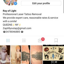 ray of light laser tattoo removal tattoo removal glendale ray of light laser tattoo removal tattoo removal glendale