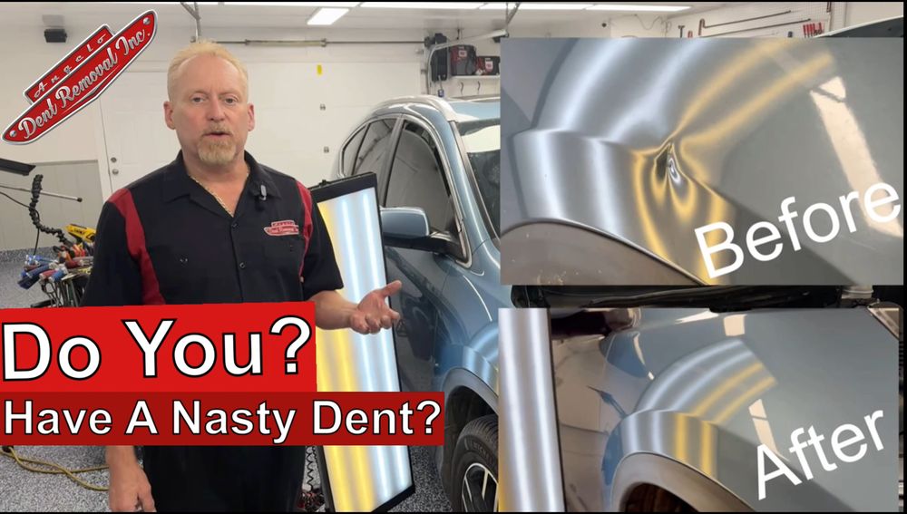 Angelo Dent Removal