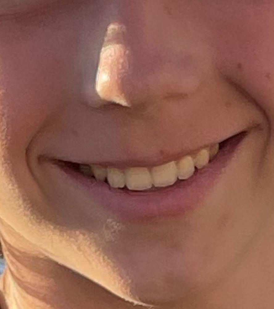 Diane M Doppel, DDS, MSD - Pacific Orthodontics