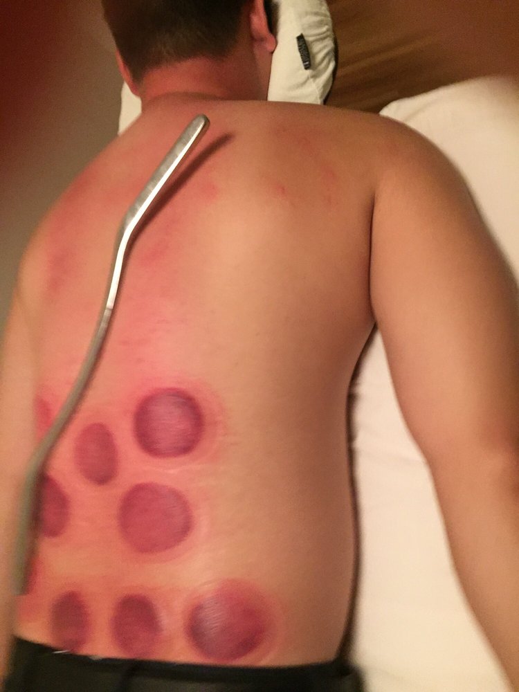 Acujin Acupuncture
