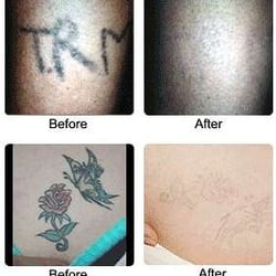 englewood laser reviews 40 w palisade ave englewood nj englewood laser reviews 40 w palisade ave englewood nj