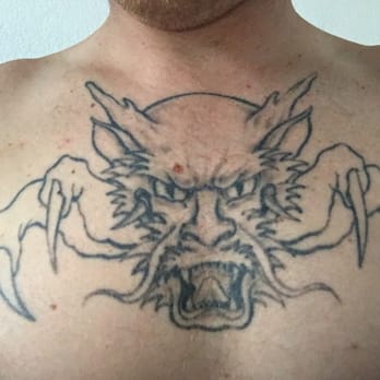 new skin tattoo removal 33 photos u0026 41 reviews tattoo removal new skin tattoo removal 33 photos u0026 41 reviews tattoo removal